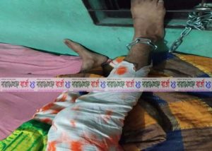 ফতুল্লায় তরুণীকে শিকল দিয়ে বেঁধে রাখায় বাবা-মা গ্রেফতার