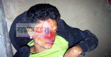 ফতুল্লায় পুলিশ সোর্সের চোখ উৎপাটন