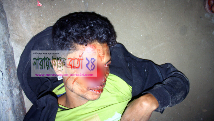 ফতুল্লায় পুলিশ সোর্সের চোখ উৎপাটন