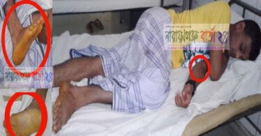 বন্দরে তনি পুলশিরে নর্যিাতনে আশংকাজনক সএিনজি চালক
