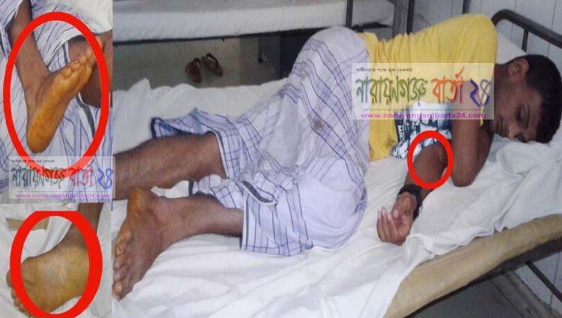 বন্দরে তনি পুলশিরে নর্যিাতনে আশংকাজনক সএিনজি চালক