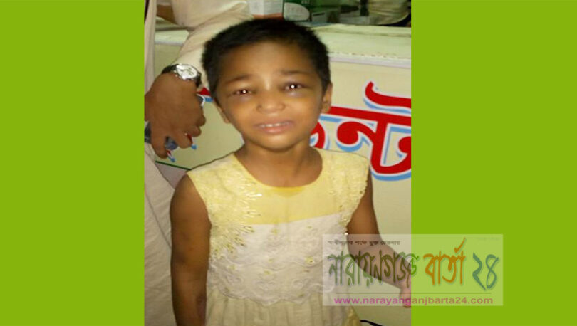 শিশু গৃহকর্মীকে খুন্তির ছেঁকা ও গরম পানি নিক্ষেপ!