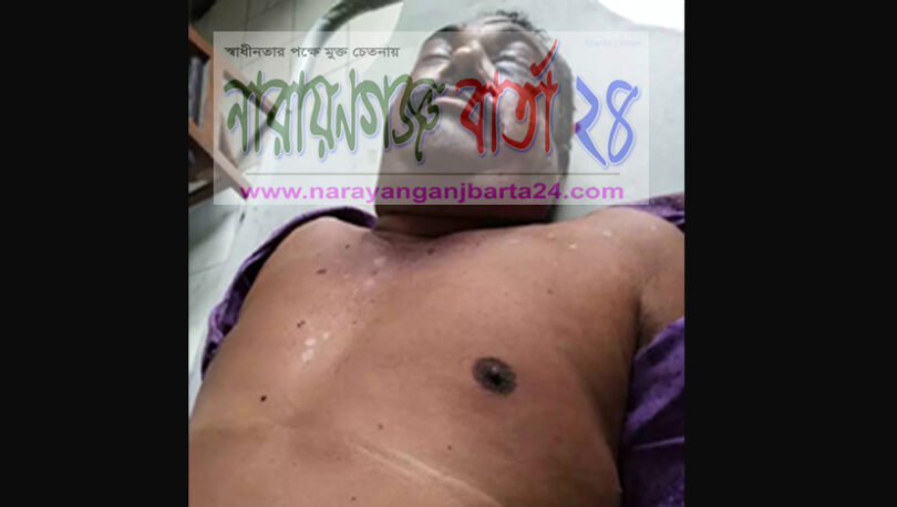 ফতুল্লায় দুই গ্রুপের টেটাযুদ্ধে নিহত ১, আহত ৯