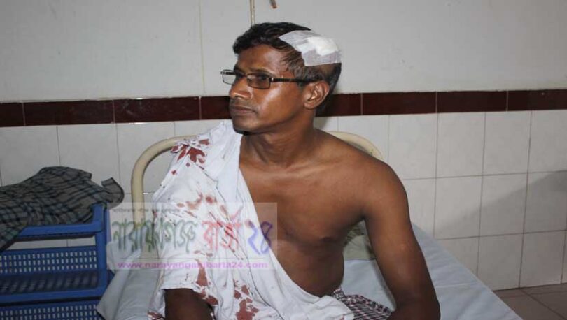 রূপগঞ্জ উপজেলা ম্যাজিস্ট্রেটের গাড়িতে হামলা, আহত-২