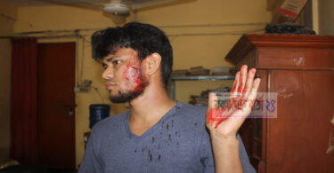 রুপগঞ্জে রংধনু রেস্টুরেন্ট মালিক বাবুর্চিকে কুপিয়ে জখম