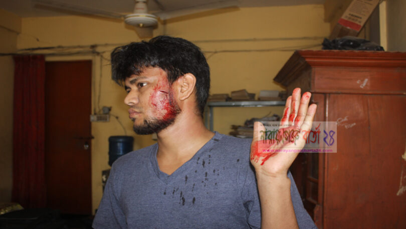 রুপগঞ্জে রংধনু রেস্টুরেন্ট মালিক বাবুর্চিকে কুপিয়ে জখম