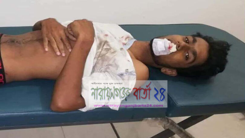 আ‌ন্দোলনকালীন পিকআপ চাপা, ‌বে‌চেঁ আ‌ছে তোলারাম ক‌লে‌জের ছাত্র ফয়সাল