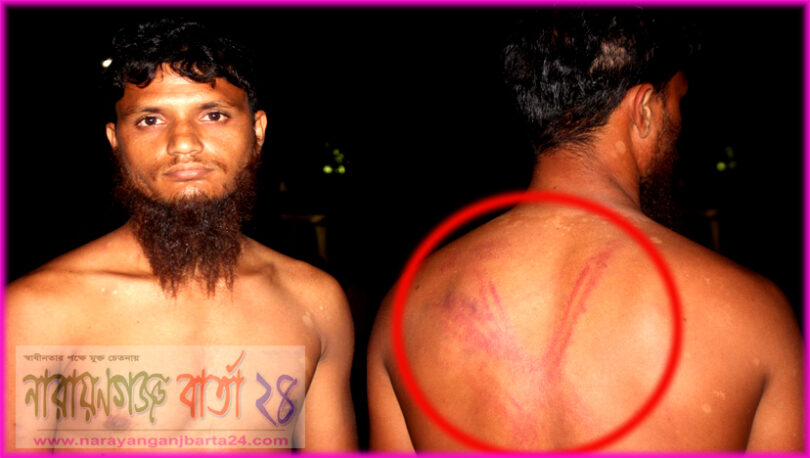 বন্দরে দিন মজুরকে শ্বাসরোধ ও পিটিয়ে হত্যার চেষ্টা