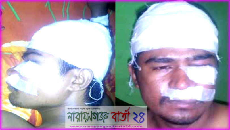 বন্দরে অটো চালক কামালকে কুপানোর ঘটনায় থানায় মামলা, আটক ৩