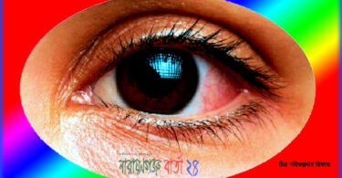 আজ রূপগঞ্জে বিনামুল্যে চক্ষু সেবা প্রদান