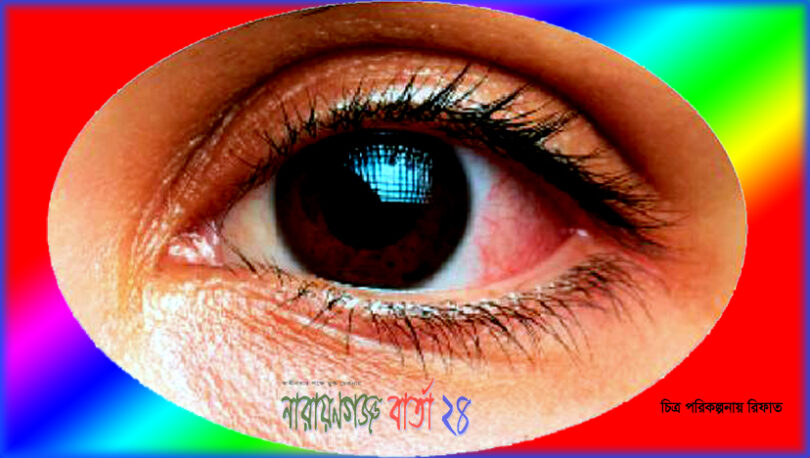 আজ রূপগঞ্জে বিনামুল্যে চক্ষু সেবা প্রদান