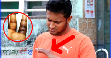 সাকিবের হাতের আঙুল আর স্বাভাবিক অবস্থায় ফিরবে না