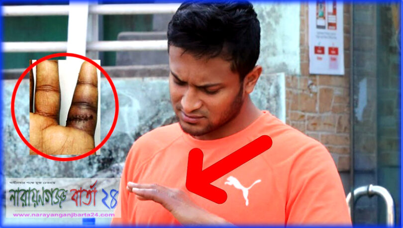 সাকিবের হাতের আঙুল আর স্বাভাবিক অবস্থায় ফিরবে না