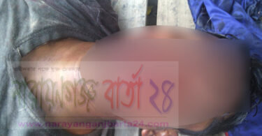 কারখানায় বিস্ফোরনে প্রাণ গেল শ্রমিকের
