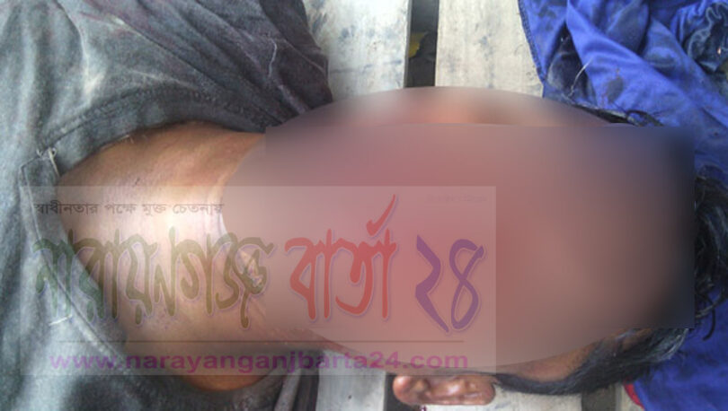 কারখানায় বিস্ফোরনে প্রাণ গেল শ্রমিকের