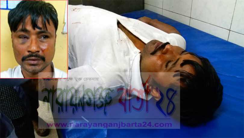 ফতুল্লায় কাটন ব্যবসায়ী নুরুল ইসলামের উপর সন্ত্রাসী হামলা