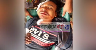 রূপগঞ্জে পুলিশের গাড়ির ধাক্কায় মটর সাইকেল চালক আহত