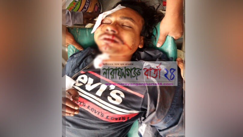রূপগঞ্জে পুলিশের গাড়ির ধাক্কায় মটর সাইকেল চালক আহত
