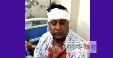 যুবলগীগ সভাপতি ও প্যানেল মেয়র মতিকে রক্তাক্ত জখম
