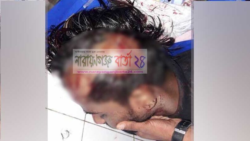 বন্দরে সন্ত্রাসী হামলায় বিশ্ববিদ্যালয় পড়ুয়া ছাত্রসহ আহত-২