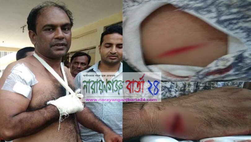 সোনারগাঁয়ে সাংবাদিকের ভাইকে কুপিয়ে হত্যার চেষ্টার অভিযোগ