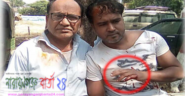 বন্দরে মুদি ব্যবসায়ীকে পিটিয়ে জখম ক্ষতস্থানে মরিচগুঁড়া নিক্ষেপ