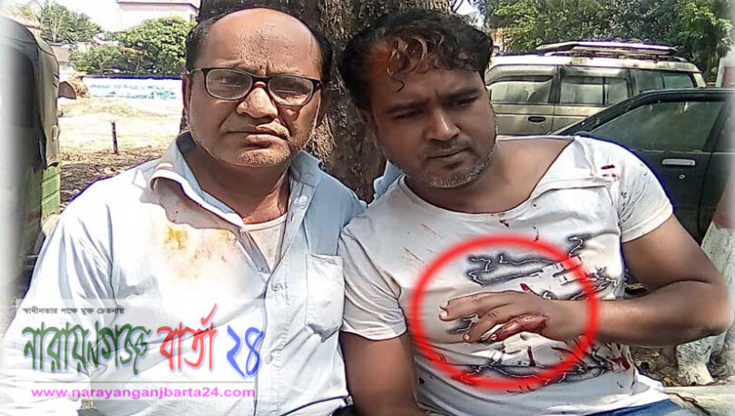 বন্দরে মুদি ব্যবসায়ীকে পিটিয়ে জখম ক্ষতস্থানে মরিচগুঁড়া নিক্ষেপ