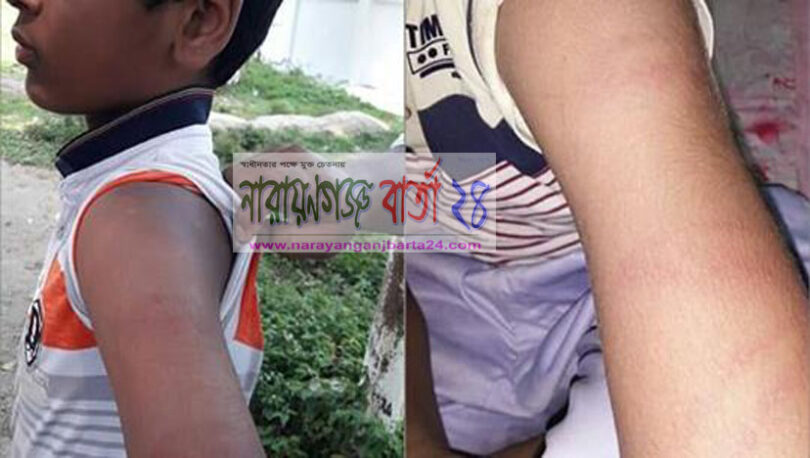 ওস্তাদ আঘাত করলে কিছু হয়না !