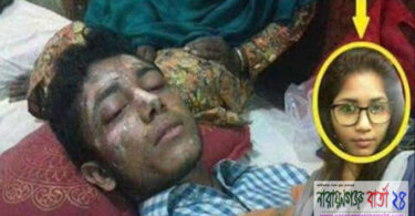 প্রেমের প্রস্তাব প্রত্যাখান করায় ছাত্রকে এসিড মারল কলেজ ছাত্রী