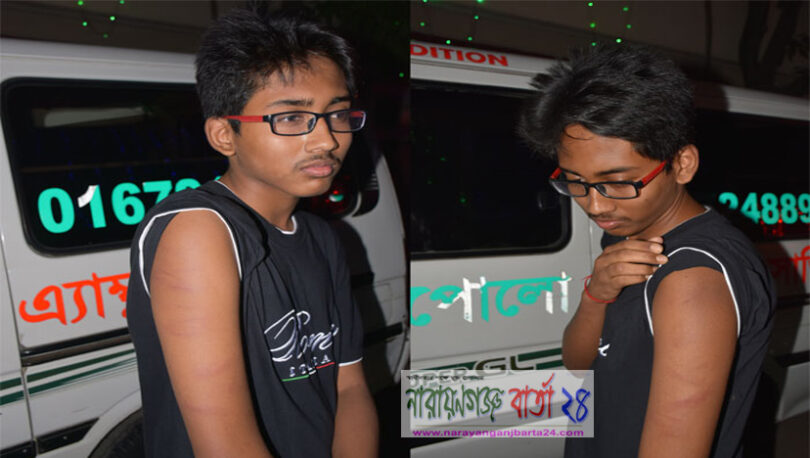 হোমওয়ার্ক না করায় ‌শিক্ষ‌কের পিটু‌নি‌তে হাসপাতা‌লে শিক্ষার্থী‌