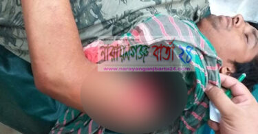রূপগঞ্জে ছাত্রলীগ নেতার রগ কেটে দিলো প্রতিপক্ষ