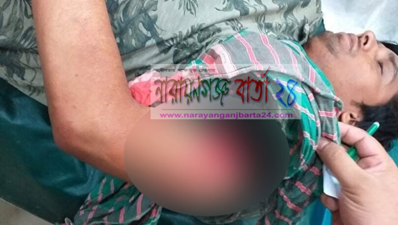 রূপগঞ্জে ছাত্রলীগ নেতার রগ কেটে দিলো প্রতিপক্ষ