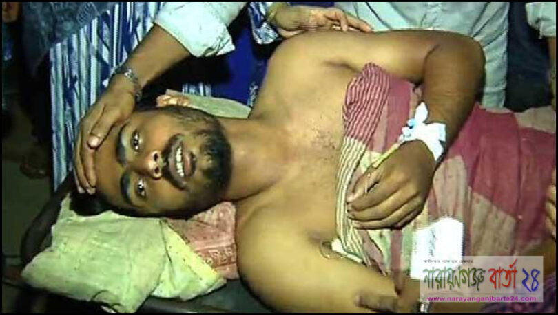 সোনাগাজীতে এবার যুবককে হাত-পা বেঁধে পুড়িয়ে মারার চেষ্টা