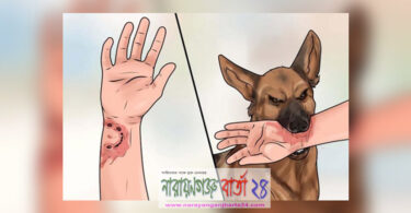 আড়াইহাজারে কুকুরের কামড়ে ৫ শিশু আহত