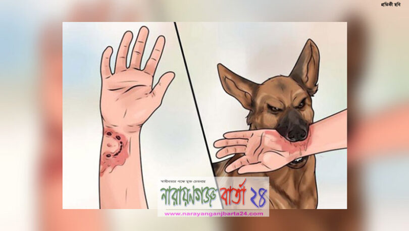 আড়াইহাজারে কুকুরের কামড়ে ৫ শিশু আহত