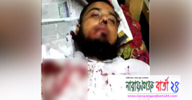 রূপগঞ্জে ব্যবসায়ীকে কুপিয়ে রক্তাক্ত জখম
