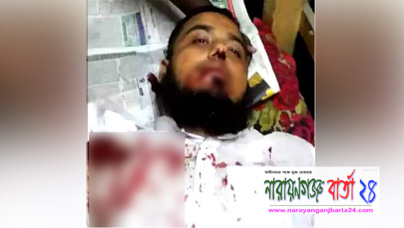 রূপগঞ্জে ব্যবসায়ীকে কুপিয়ে রক্তাক্ত জখম