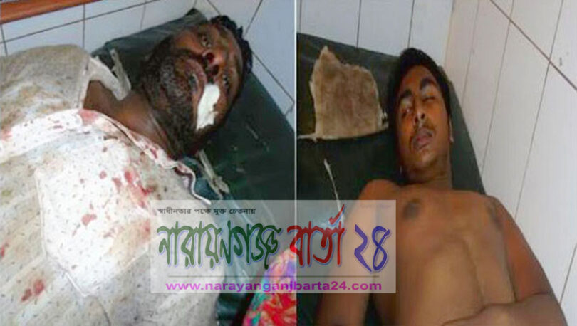 আড়াইহাজারে একই পরিবারের ৫ জনকে কুপিয়ে জখম