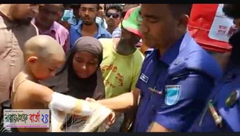 সোনারগাঁয়ে শিশুর শরীরে ব্যান্ডেজ লাগিয়ে অভিনব কায়দায় ভিক্ষা