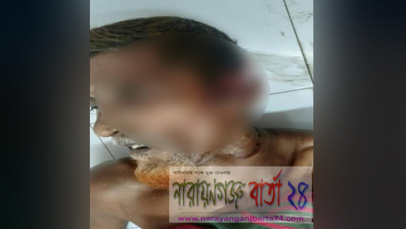 বন্দরে আম পাড়া নিয়ে সংঘর্ষে বৃদ্ধ নিহত, আহত ৪