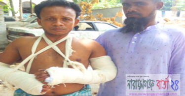 বড় ভাইকে কুপিয়ে জখম করেছে ছোট ভাইয়ের শ্বশুর বাড়ীর লোকজনেরা
