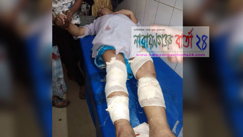 ফতুল্লায় আওয়ামী লীগ নেতা ও ছেলেকে কুপিয়ে জখম