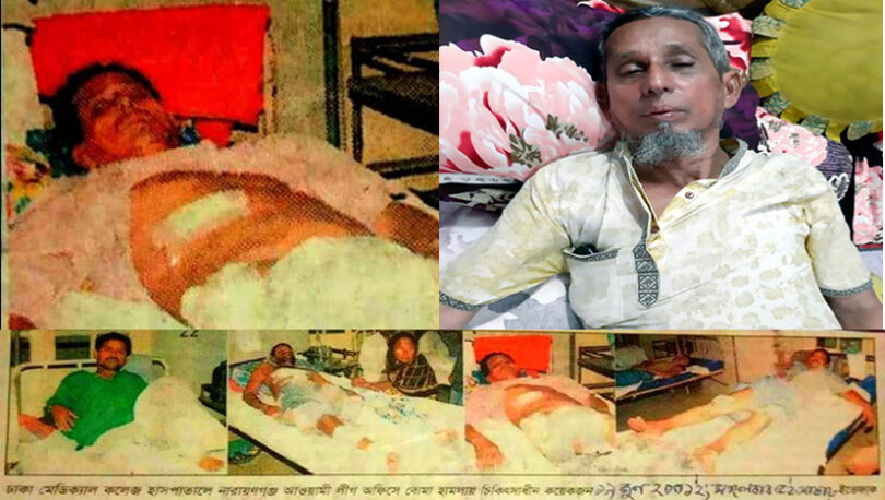 বেচেঁ আছি, মৃত্যু হলে কে খোঁজ নিতো ?