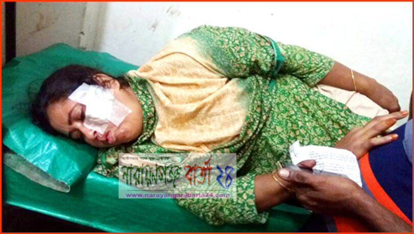বন্দরে সাবেক মেম্বারকে কুপিয়ে জখম