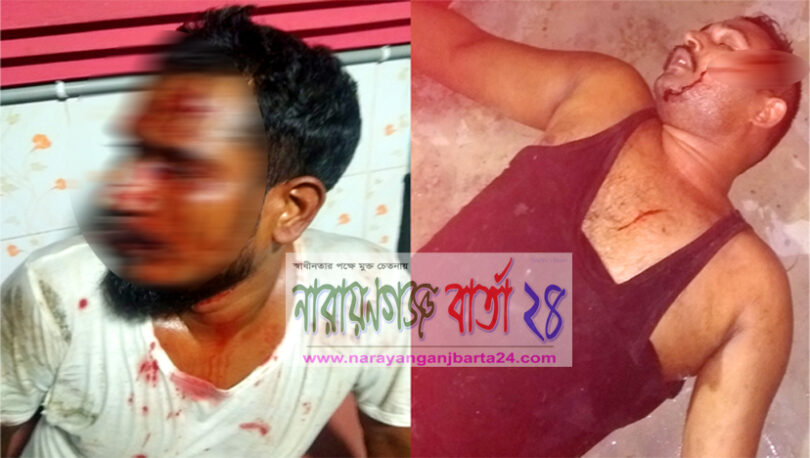 বন্দরে মাদক বিক্রিতে বাধা দেয়ায় সন্ত্রাসীদের হামলায় আহত-৪