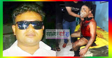 ফতুল্লায় ছাত্রলীগ নেতাকে কুপিয়ে জখম ও এসিড নিক্ষেপ