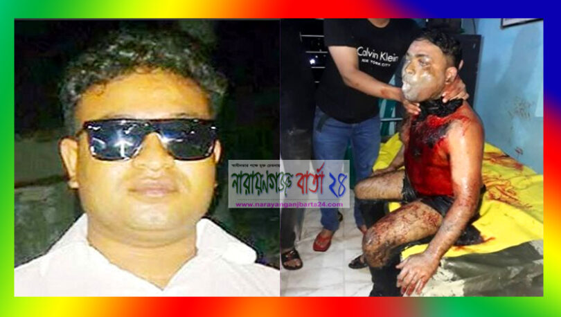 ফতুল্লায় ছাত্রলীগ নেতাকে কুপিয়ে জখম ও এসিড নিক্ষেপ