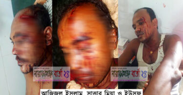 সোনারগাঁয়ে তুচ্ছ ঘটনায় ৩ ভাইকে পিটিয়ে জখম