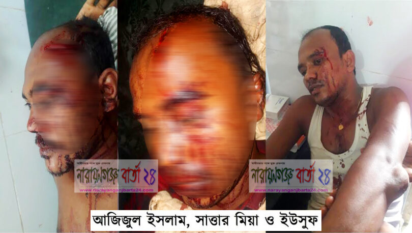 সোনারগাঁয়ে তুচ্ছ ঘটনায় ৩ ভাইকে পিটিয়ে জখম