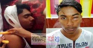 বন্দরে ৩ স্কুল শিক্ষার্থীকে কুপিয়েছে সহপাঠিরা